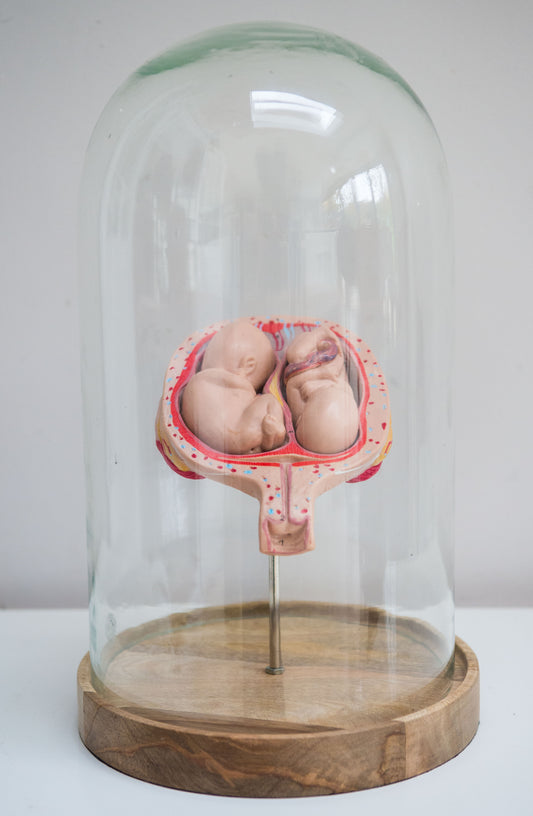 A Mid Century Anatomical Anatomy Medical Model of twin human fetuses